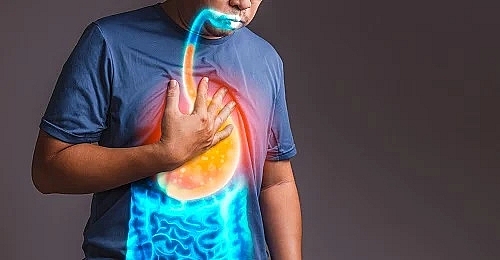 Các nguyên nhân gây ợ nóng thường gặp