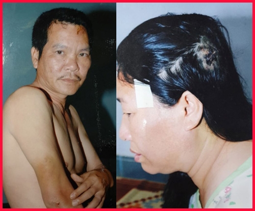 Trở lại bài viết “Xung quanh việc bà Nguyễn Thị Năm, ông Nguyễn Xuân Thanh bị khởi tố về hành vi sử dụng nhiều người uy hiếp tinh thần để chiếm đoạt t