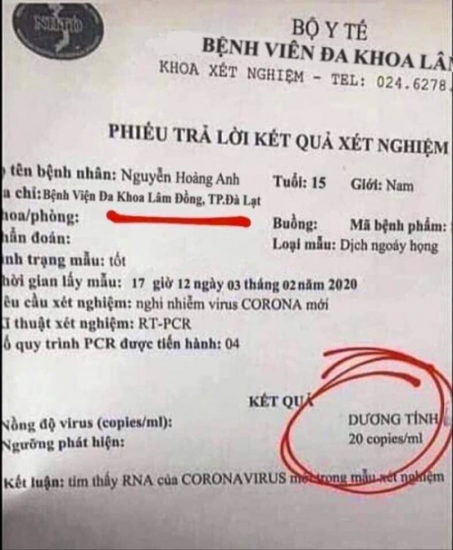 Xuất hiện kết quả xét nghiệm nhiễm virus Corona giả