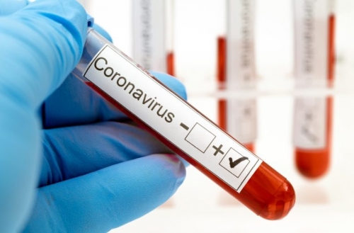 Nga phát hiện biến chứng nguy hiểm do virus corona gây ra