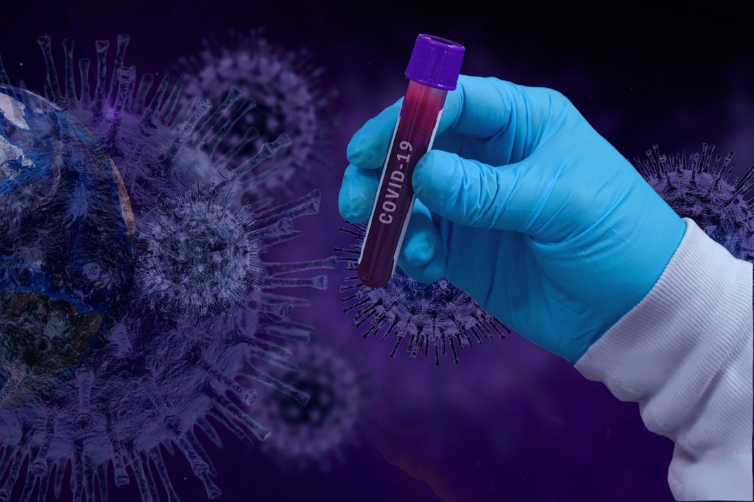Giới chức Mỹ đ&atilde; nghi ngờ virus SARS-CoV-2 xuất ph&aacute;t từ một ph&ograve;ng th&iacute; nghiệm ở Vũ H&aacute;n, Trung Quốc.