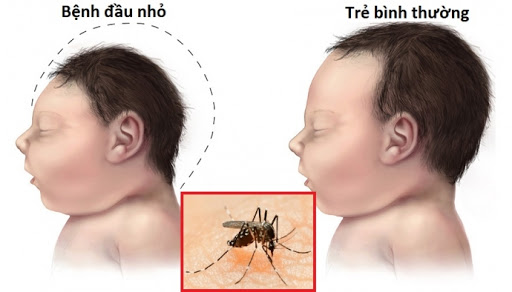 Ca bệnh Zika đầu tiên năm 2020 và 3 trường hợp tử vong vì sốt xuất huyết: Bộ Y tế yêu cầu tăng cường phòng chống các dịch bệnh này