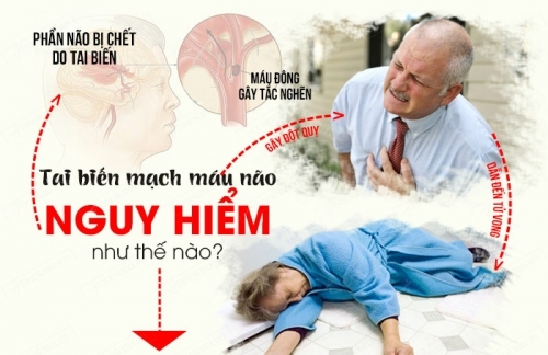Cách phòng chống bệnh tai biến mạch máu não
